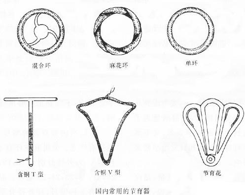 女性最新节育方法详解，全面数据与专业解读