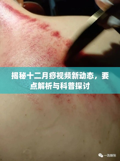 揭秘十二月痧视频最新动态，要点解析与深度科普探讨