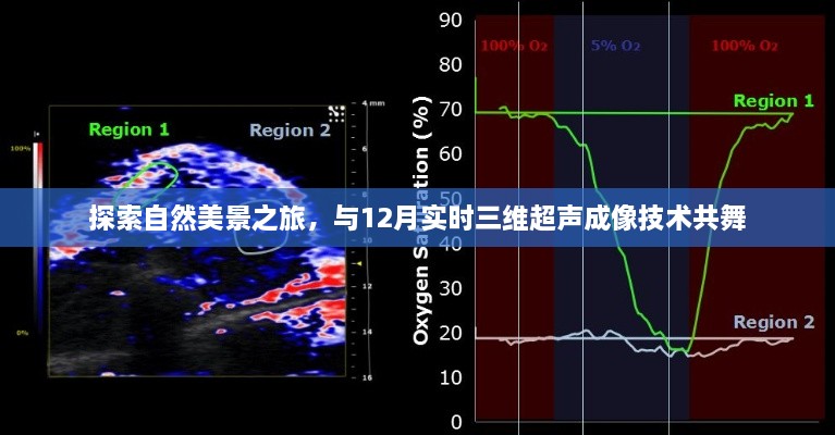 自然美景探索之旅，与最新三维超声成像技术共舞揭秘十二月风采